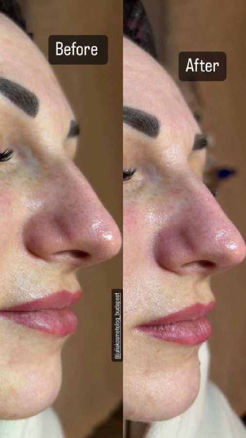 Yuliia Ivanova — cosmetologist